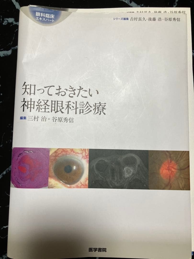 (裁断済み)知っておきたい神経眼科診療